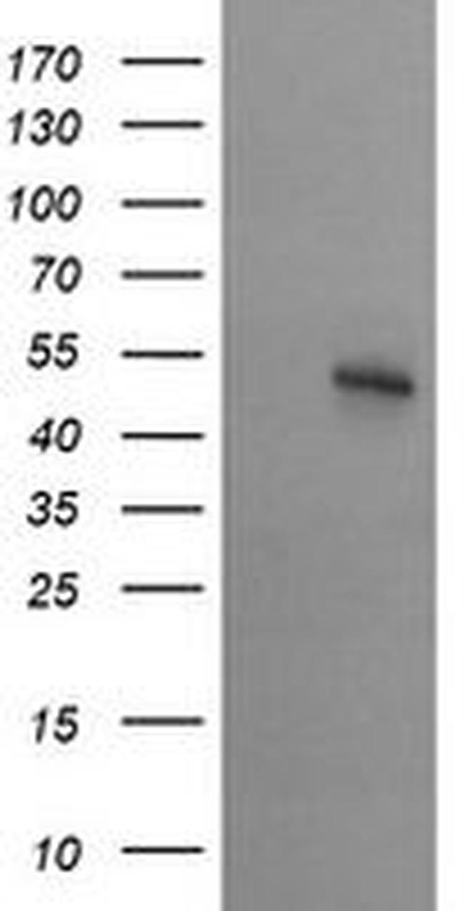 STK38L Antibody in Western Blot (WB)