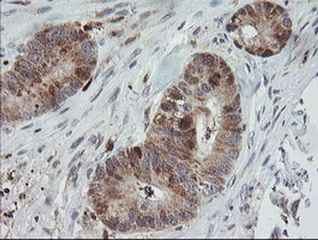 MRPS34 Antibody in Immunohistochemistry (Paraffin) (IHC (P))