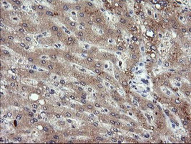 PIK3CG Antibody in Immunohistochemistry (Paraffin) (IHC (P))