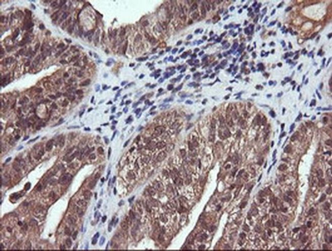 PIK3CG Antibody in Immunohistochemistry (Paraffin) (IHC (P))