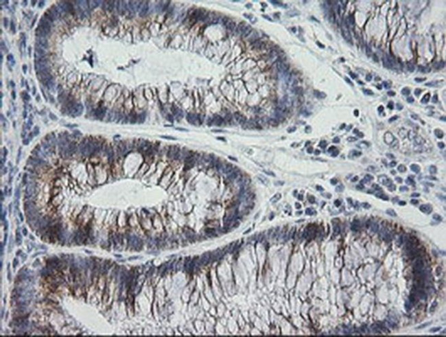 MRPS34 Antibody in Immunohistochemistry (Paraffin) (IHC (P))