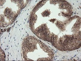 UBE2G2 Antibody in Immunohistochemistry (Paraffin) (IHC (P))