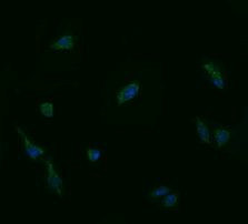 UBE2G2 Antibody in Immunocytochemistry (ICC/IF)