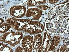 UBE2G2 Antibody in Immunohistochemistry (Paraffin) (IHC (P))