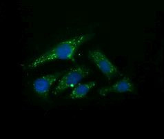 UBE2G2 Antibody in Immunocytochemistry (ICC/IF)