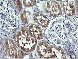 UBE2G2 Antibody in Immunohistochemistry (Paraffin) (IHC (P))