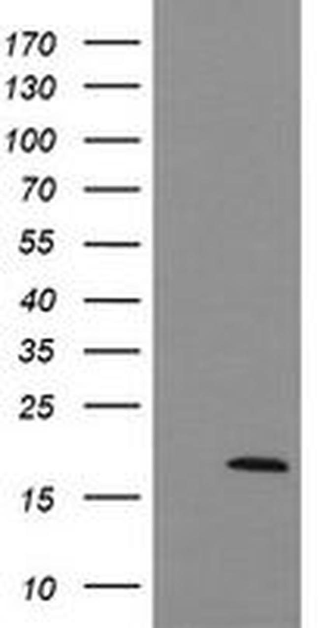 UBE2G2 Antibody in Western Blot (WB)