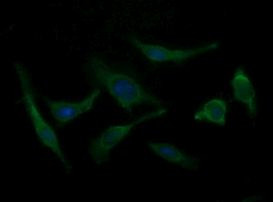 B3GNT2 Antibody in Immunocytochemistry (ICC/IF)