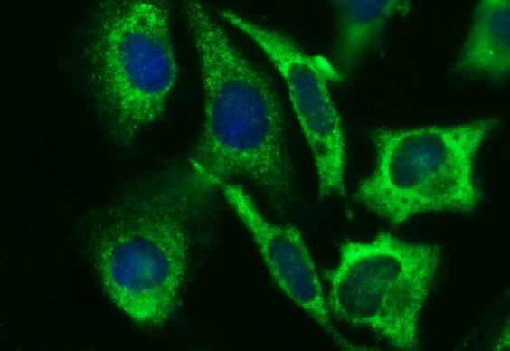 B3GNT2 Antibody in Immunocytochemistry (ICC/IF)