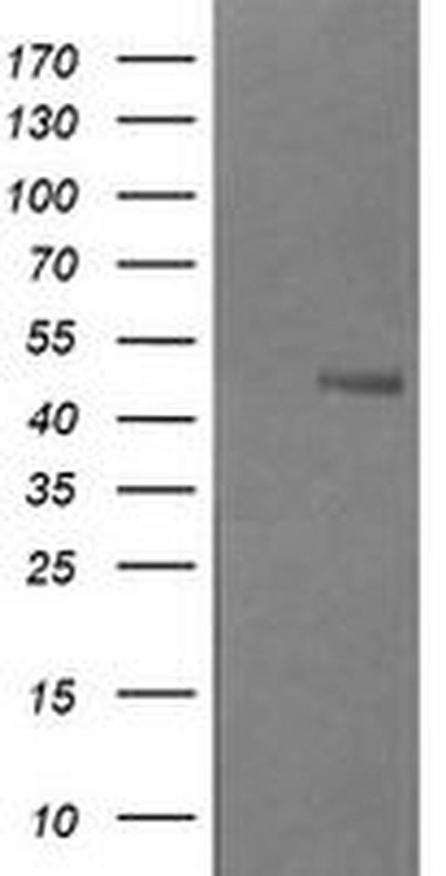 B3GNT2 Antibody in Western Blot (WB)