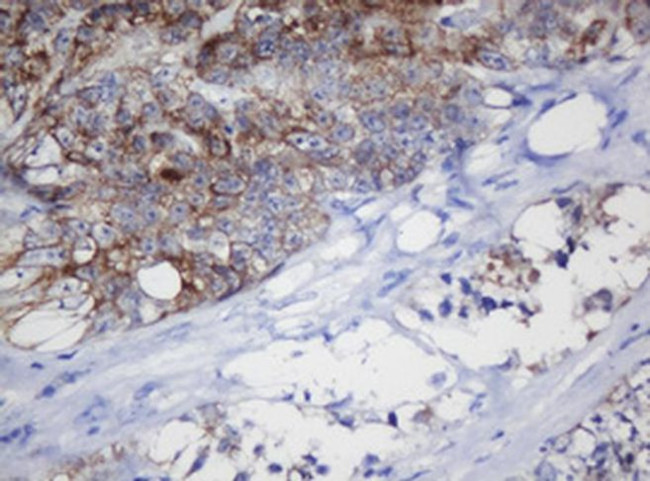 MRPL11 Antibody in Immunohistochemistry (Paraffin) (IHC (P))