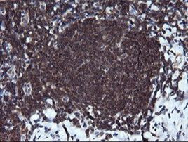 RAB37 Antibody in Immunohistochemistry (Paraffin) (IHC (P))