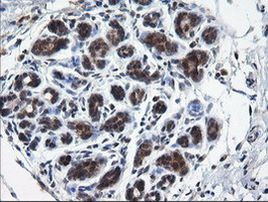 RAB37 Antibody in Immunohistochemistry (Paraffin) (IHC (P))