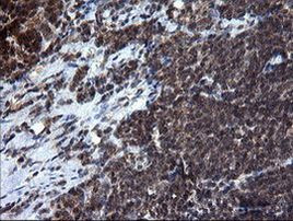 RAB37 Antibody in Immunohistochemistry (Paraffin) (IHC (P))