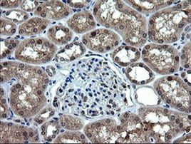 RAB37 Antibody in Immunohistochemistry (Paraffin) (IHC (P))