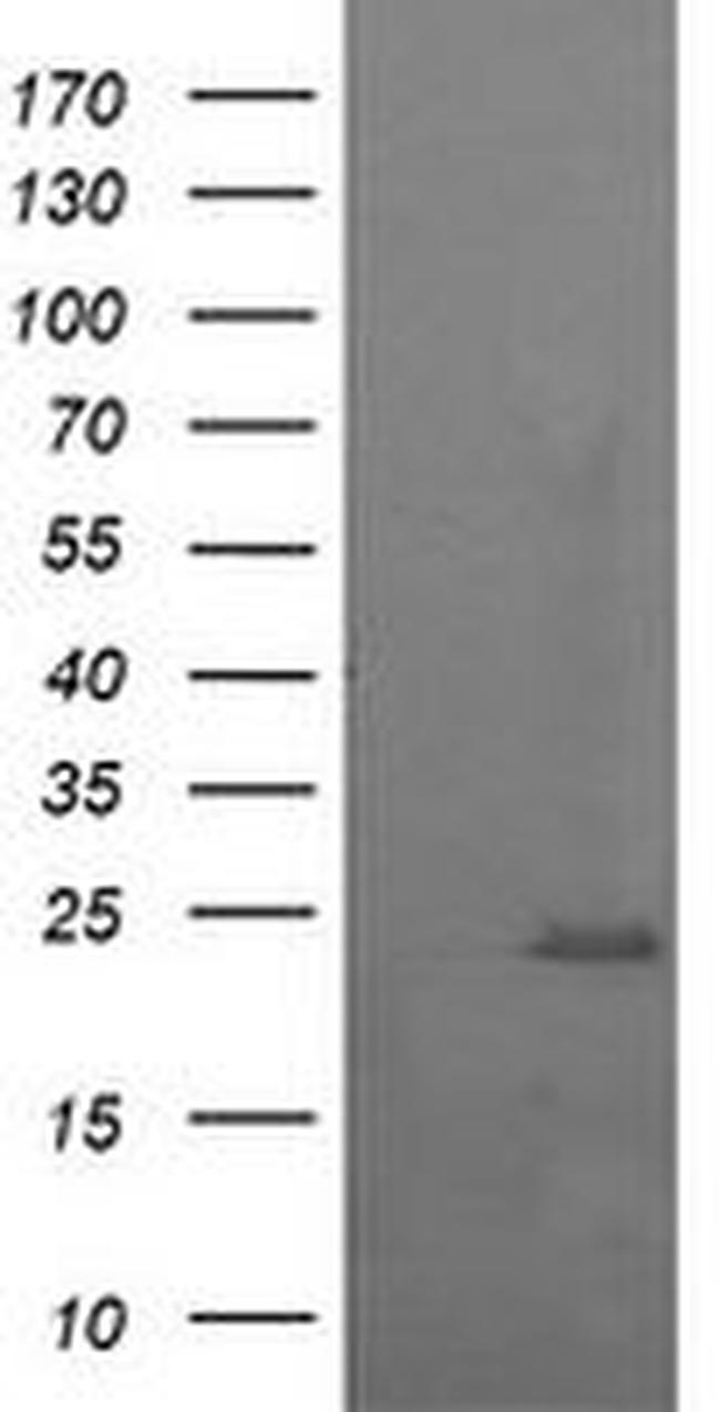 RAB37 Antibody in Western Blot (WB)