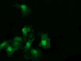 RAB30 Antibody in Immunocytochemistry (ICC/IF)