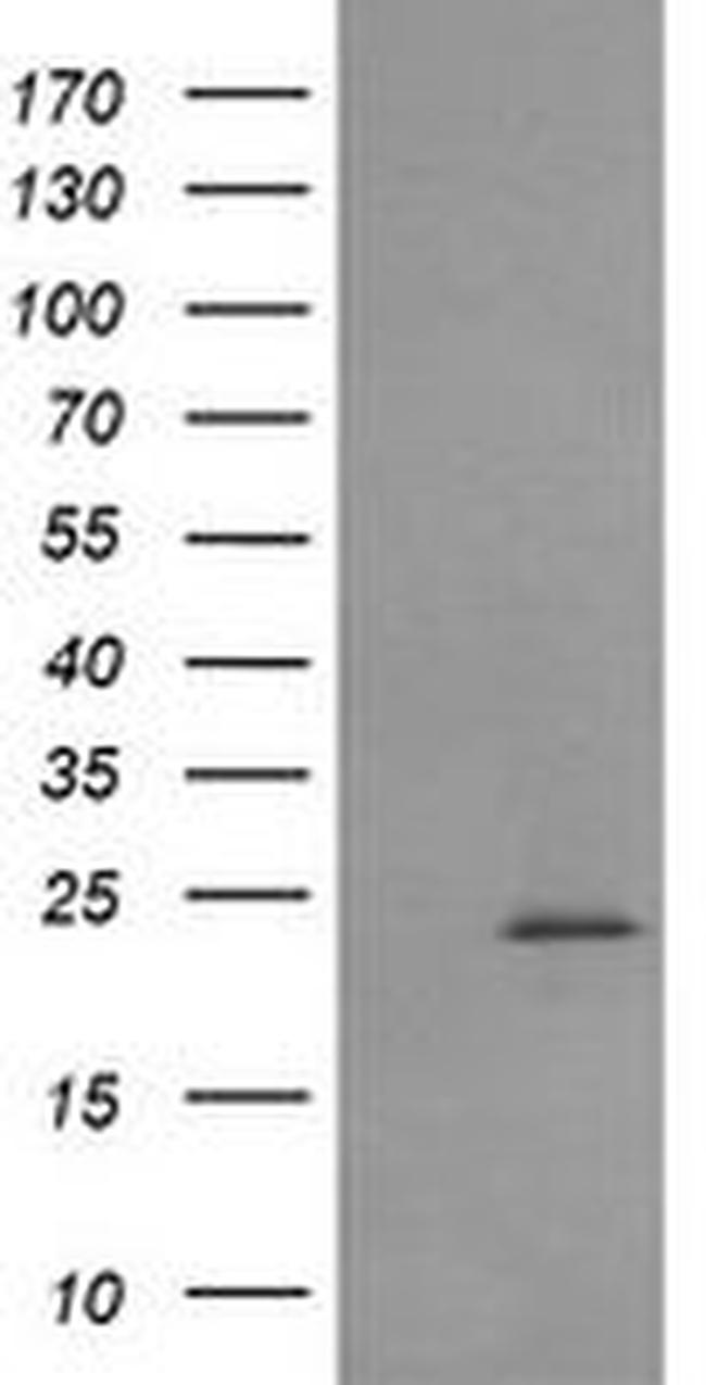 RAB30 Antibody in Western Blot (WB)