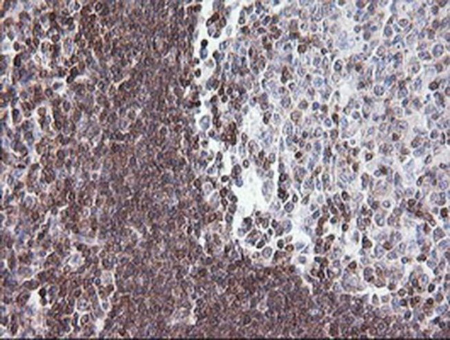 DEF6 Antibody in Immunohistochemistry (Paraffin) (IHC (P))