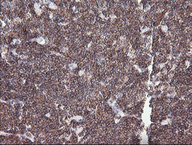 DEF6 Antibody in Immunohistochemistry (Paraffin) (IHC (P))