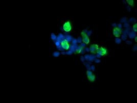 RAB37 Antibody in Immunocytochemistry (ICC/IF)