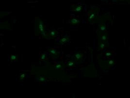 RAB30 Antibody in Immunocytochemistry (ICC/IF)