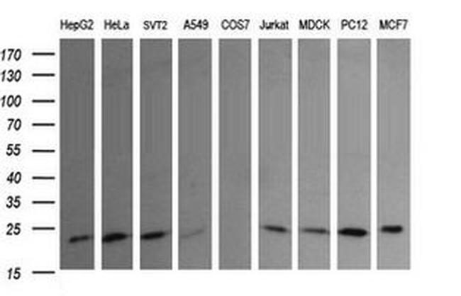 RAB30 Antibody in Western Blot (WB)