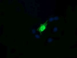 RAB30 Antibody in Immunocytochemistry (ICC/IF)