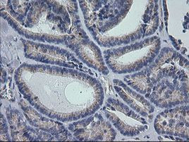 RAB30 Antibody in Immunohistochemistry (Paraffin) (IHC (P))