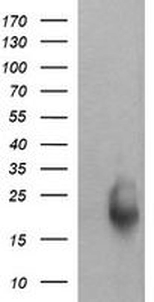 RAB30 Antibody in Western Blot (WB)