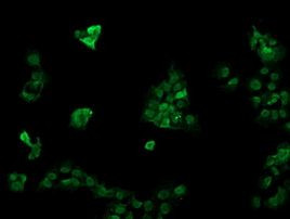 RAB30 Antibody in Immunocytochemistry (ICC/IF)