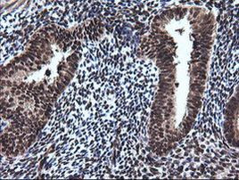 RAB30 Antibody in Immunohistochemistry (Paraffin) (IHC (P))