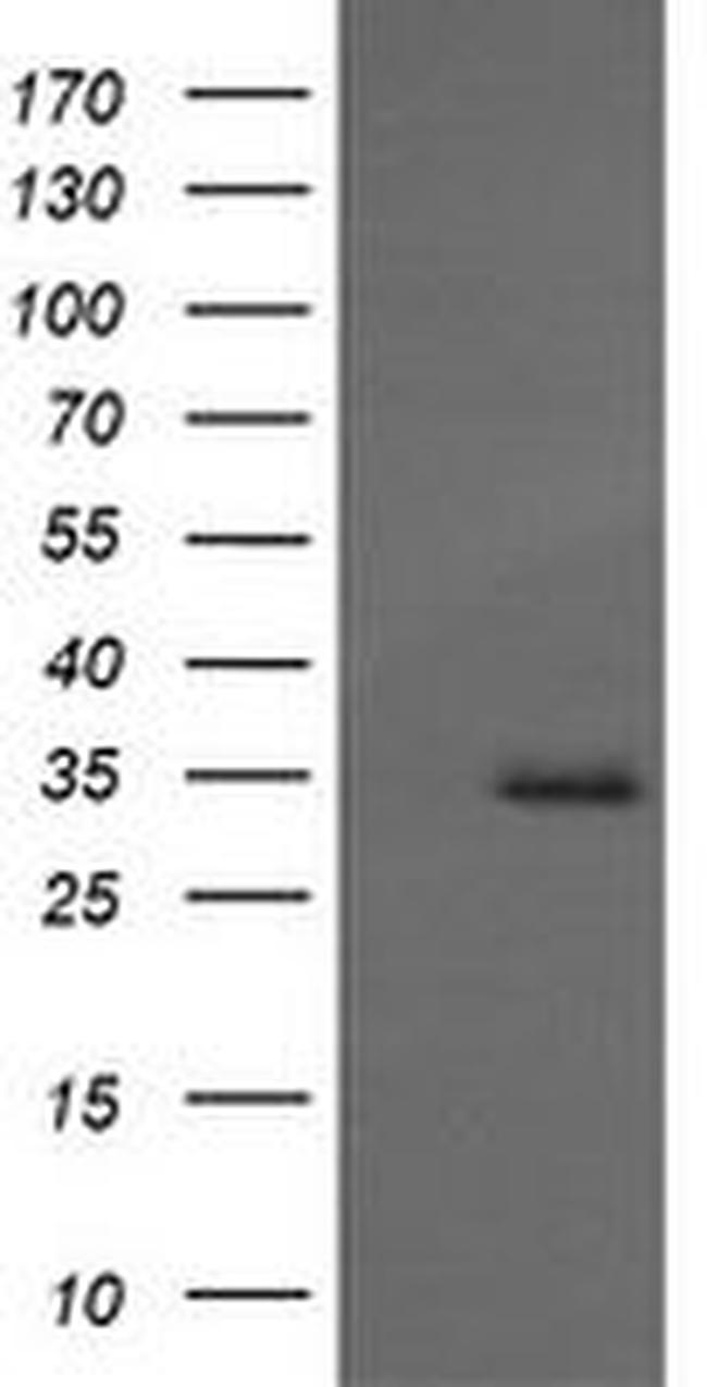 MAGEA4 Antibody in Western Blot (WB)