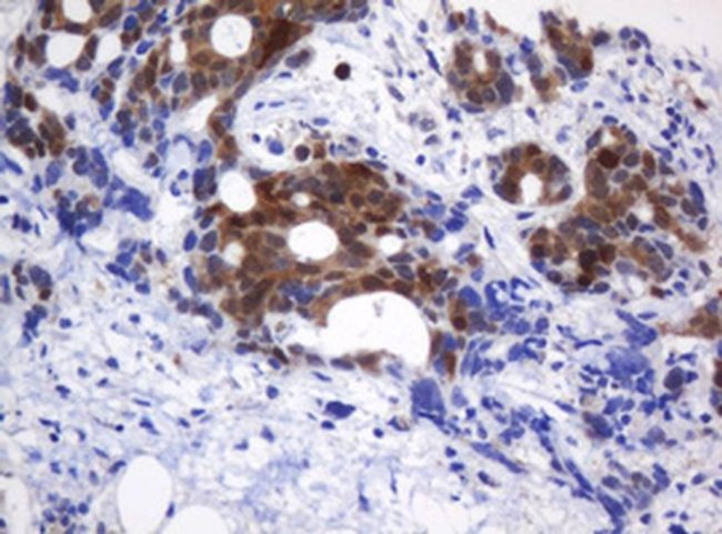 CMPK1 Antibody in Immunohistochemistry (Paraffin) (IHC (P))