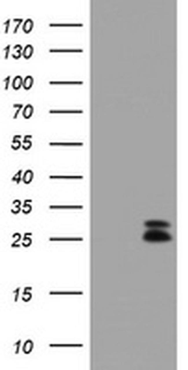 CMPK1 Antibody in Western Blot (WB)