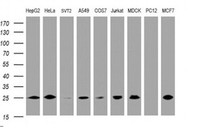 CMPK1 Antibody in Western Blot (WB)