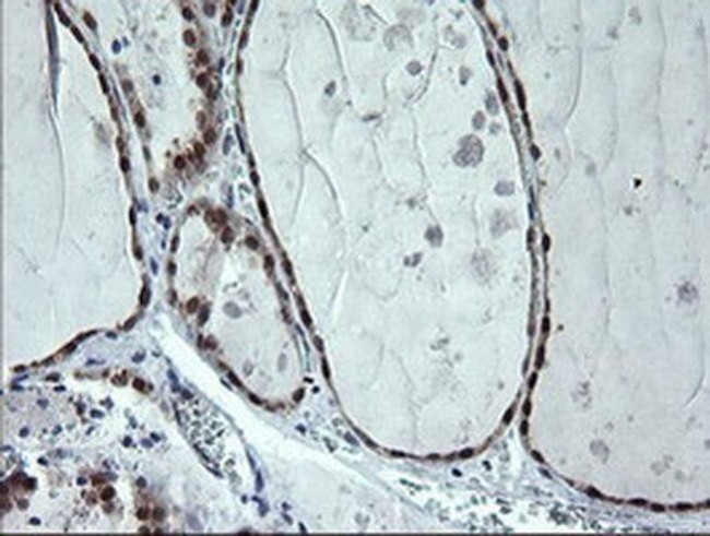 CMPK1 Antibody in Immunohistochemistry (Paraffin) (IHC (P))