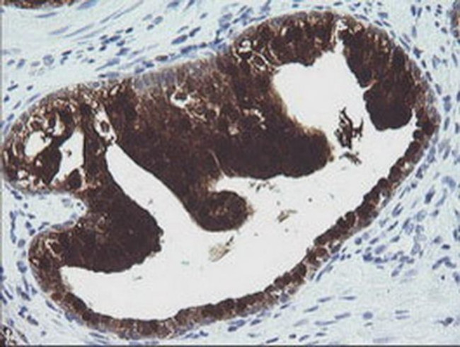 CMPK1 Antibody in Immunohistochemistry (Paraffin) (IHC (P))