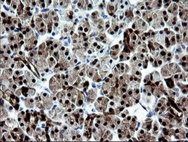 CMPK1 Antibody in Immunohistochemistry (Paraffin) (IHC (P))