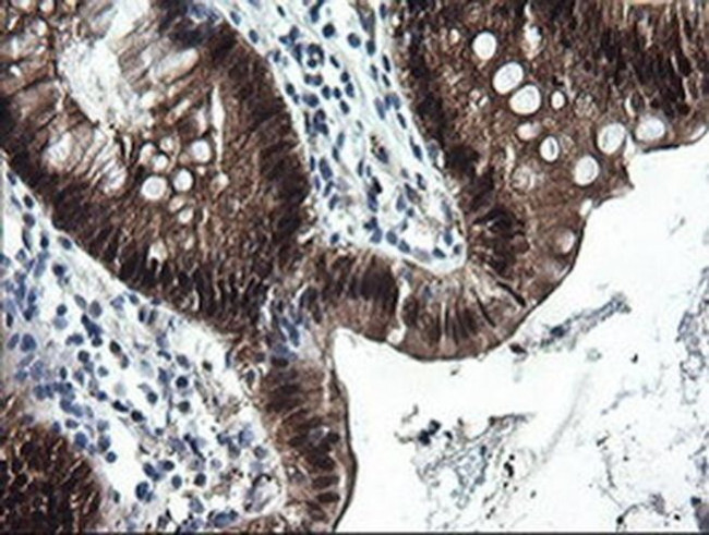 CMPK1 Antibody in Immunohistochemistry (Paraffin) (IHC (P))