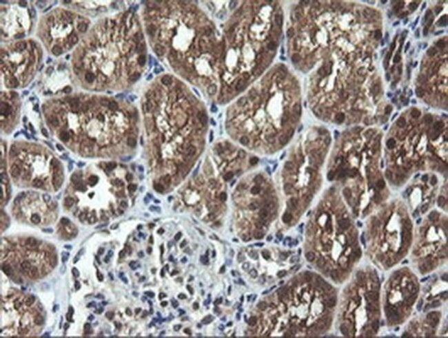 CMPK1 Antibody in Immunohistochemistry (Paraffin) (IHC (P))