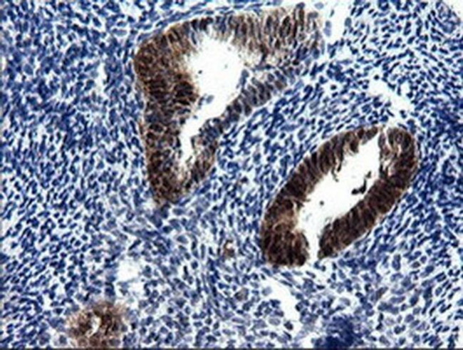 CMPK1 Antibody in Immunohistochemistry (Paraffin) (IHC (P))