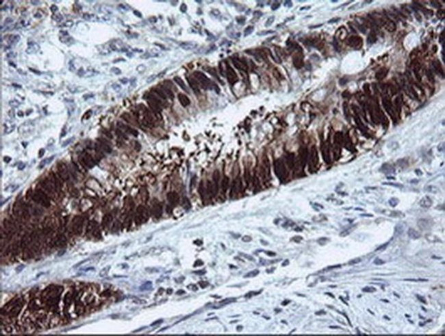 CMPK1 Antibody in Immunohistochemistry (Paraffin) (IHC (P))