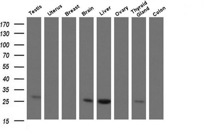 CMPK1 Antibody in Western Blot (WB)