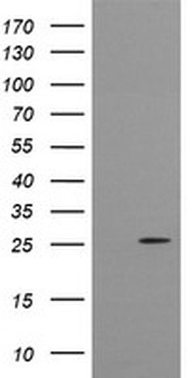 CMPK1 Antibody in Western Blot (WB)