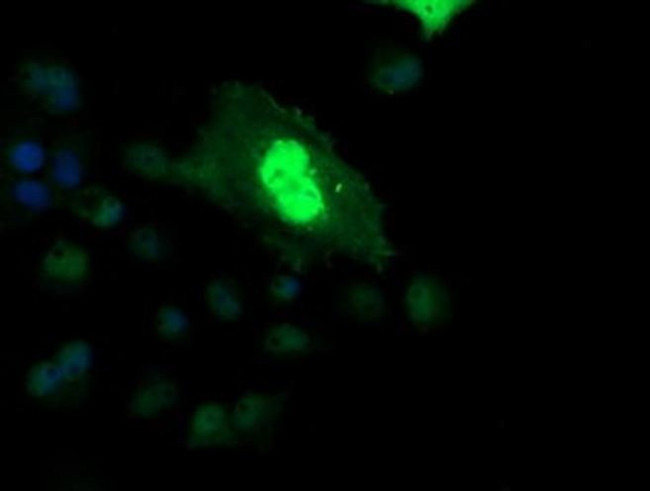 ETS2 Antibody in Immunocytochemistry (ICC/IF)