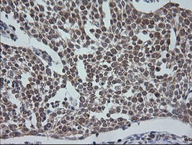 ETS2 Antibody in Immunohistochemistry (Paraffin) (IHC (P))