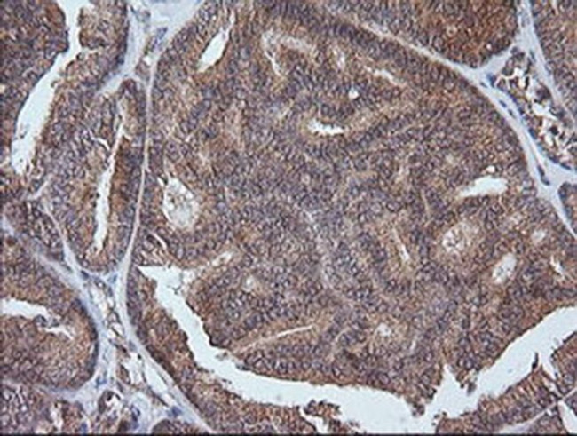 ETS2 Antibody in Immunohistochemistry (Paraffin) (IHC (P))