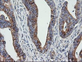 PTGES2 Antibody in Immunohistochemistry (Paraffin) (IHC (P))