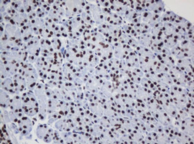 DCPS Antibody in Immunohistochemistry (Paraffin) (IHC (P))